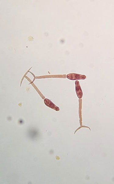 Cercaire de Schistosoma